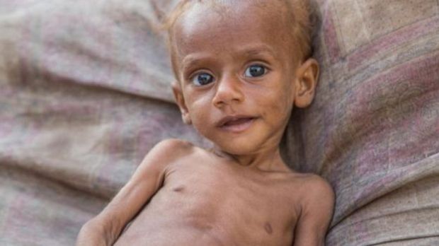 هام : منسق الإغاثة بالأمم المتحدة يحذر: اليمن "على حافة كارثة"