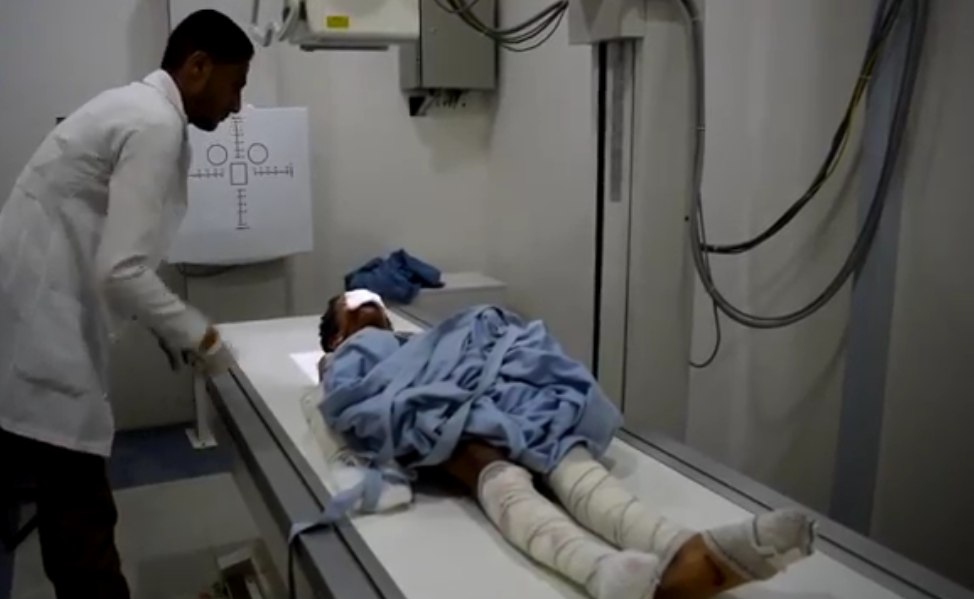 إصابة نساء وأطفال من أسرة واحدة جراء انفجار لغم حوثي في الجوف