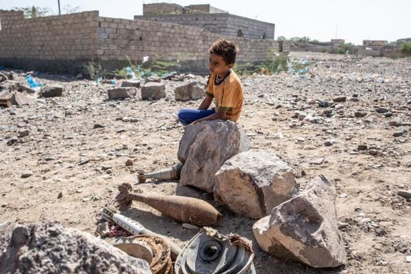 رصاصة حوثية تمزق شرايين قدم طفل في الدريهمي بالحديدة