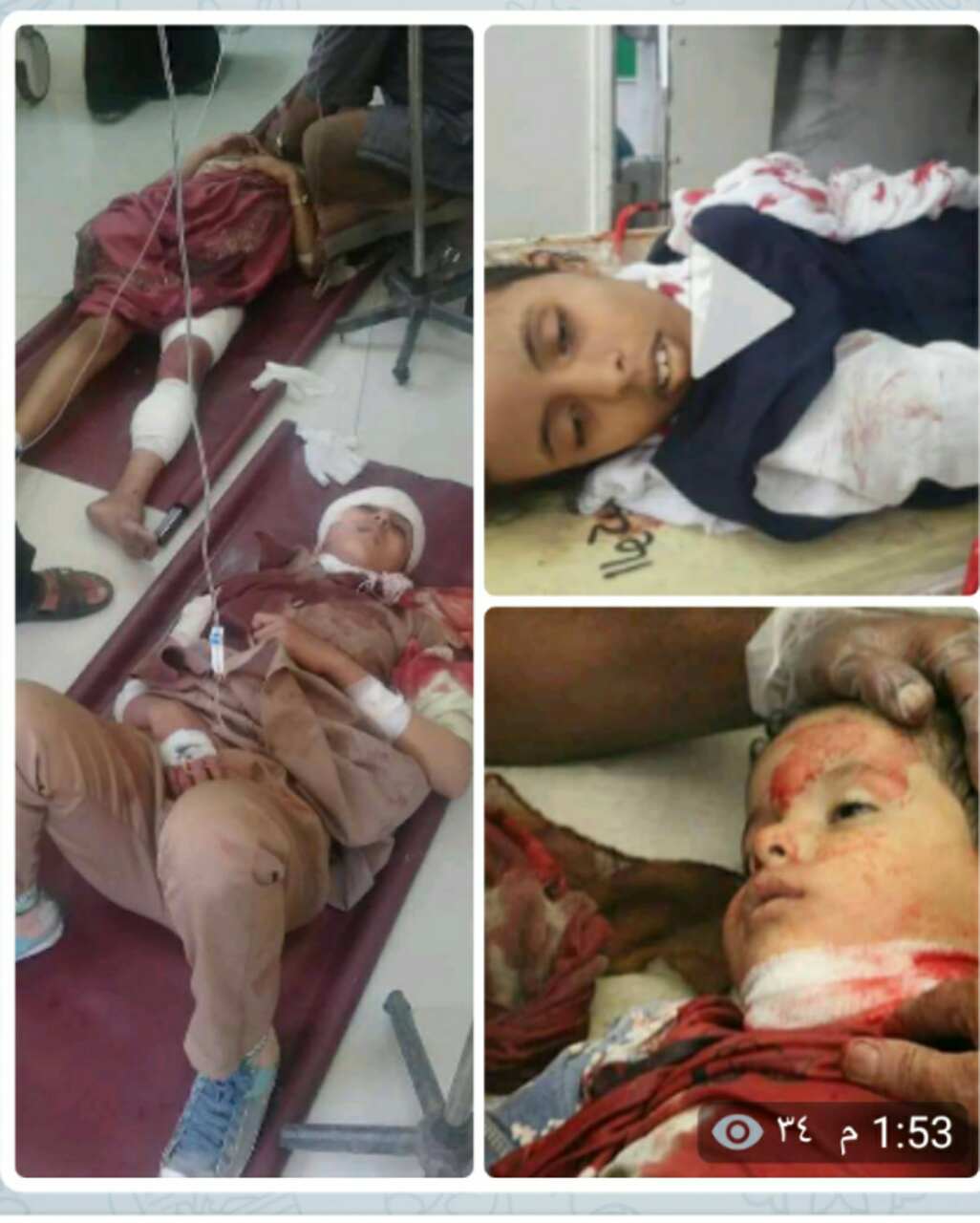  تعز| استشهاد وإصابة 4 طالبات بقذيفة حوثية واستشهاد طفل برصاص الخارجين عن القانون